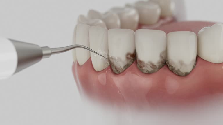 Trusted Emergency Dentist service in Marceline, MO - Dentist Open Now